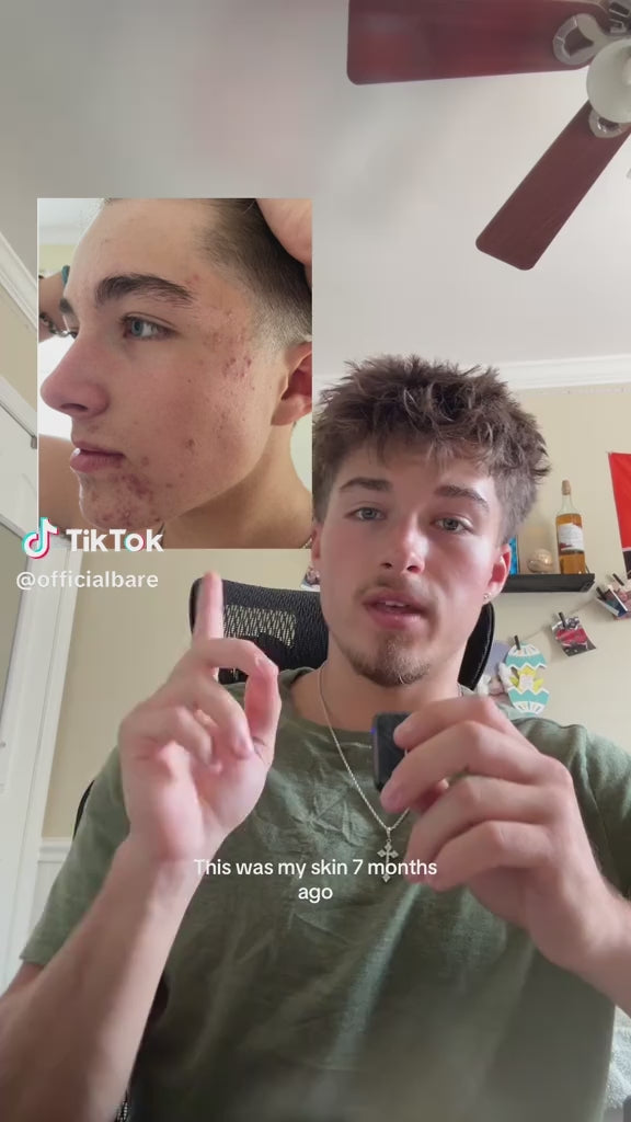 Bare Face Wash TikTok result video 2